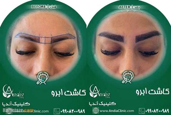 کلینیک زیبایی آندیا