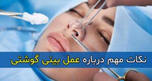 نکات مهم درباره عمل بینی گوشتی + عوارض و نحوه انجام