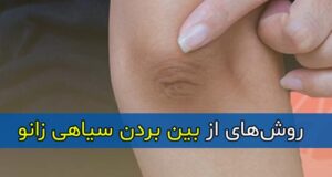 روش های از بین بردن سیاهی و تیرگی زانو و آرنج و قوزک پا در منزل و پزشکی