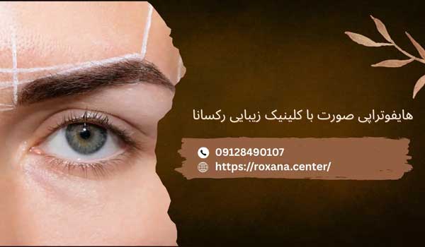 هایفوتراپی ابرو در تهران