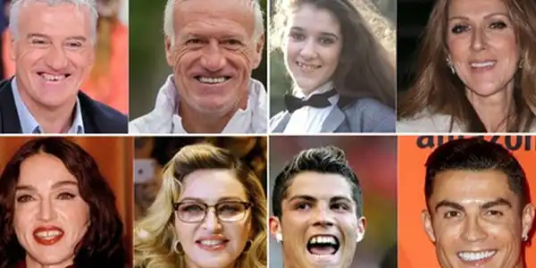 تغییر چهره بازیگران با زیبایی دندان