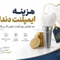 چه عواملی در تعیین هزینه های ایمپلنت دندان موثر است؟