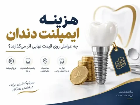 چه عواملی در تعیین هزینه های ایمپلنت دندان موثر است؟