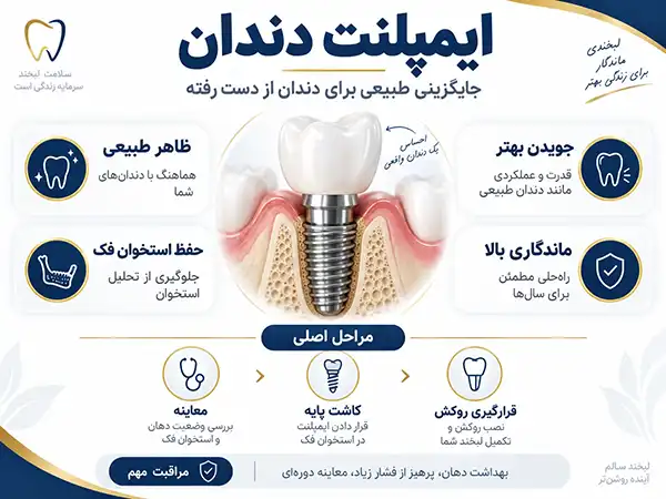 چه عواملی در تعیین هزینه های ایمپلنت دندان موثر است؟ 2 مهمترین عوامل مؤثر بر هزینه ایمپلنت دندان